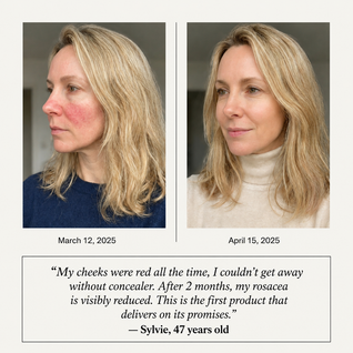 Apris - Anti-Redness Serum