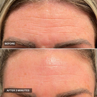 Apris - Wrinkle Smoother