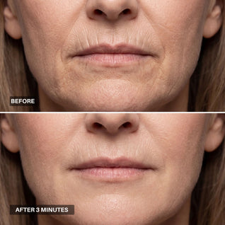Apris - Wrinkle Smoother