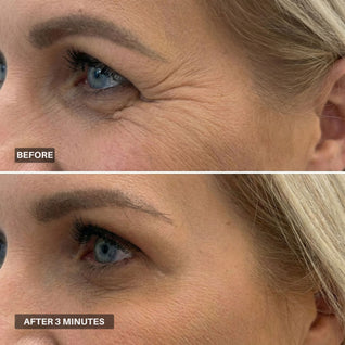 Apris - Wrinkle Smoother