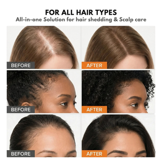 Apris - New Hair Brush Serum