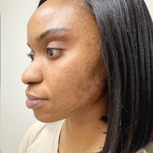 Week 5 : Transformation